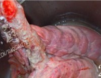 推荐几款对抗雾霾天的日常饮食 对抗雾霾天气有妙招 罗汉果杏仁猪肺汤的做法图解2